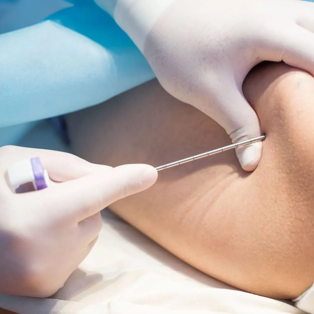 Olympus ViziShot 2 FLEX: Akciğer Biyopsisinde İleri Teknoloji ve FDA Uyarısı