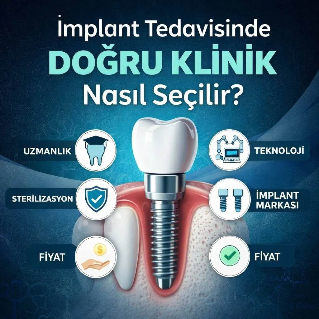 İmplant Tedavisinde Doğru Klinik Nasıl Seçilir?